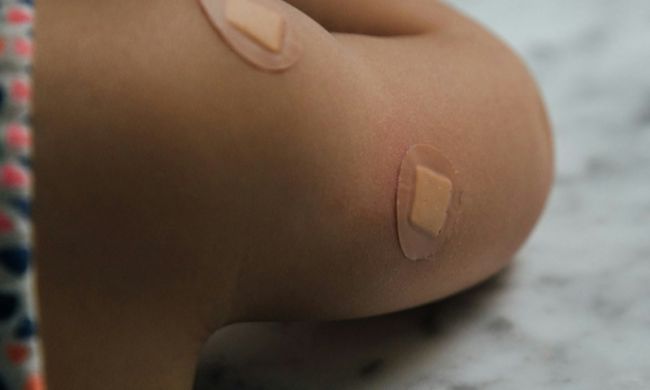 Skaleczenia i zadrapania: kiedy należy założyć opatrunek?