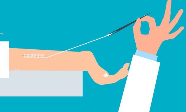 Jak odróżnić szwy rozpuszczalne od zwykłych? Prosty poradnik