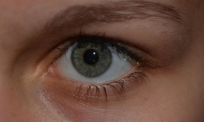 Usuwanie znamion: skalpel czy laser? Wyjaśniamy