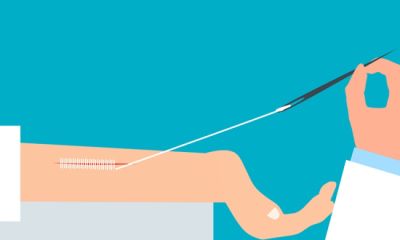 Jak dbać o ranę po założeniu szwów rozpuszczalnych?