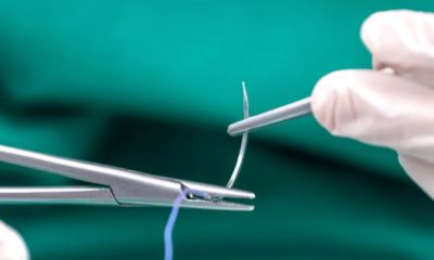 Szwy czy staplery? Który szew szybciej się zagoi?